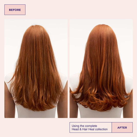 Head & Hair Heal Conditioner 300ml by Maria Nila