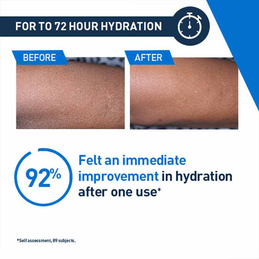 Intensive Moisturising Lotion For Very Dry Itchy Skin by CeraVe