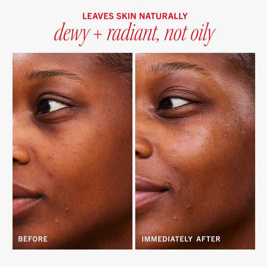 Hydrating Dewy Gel Cream by First Aid Beauty