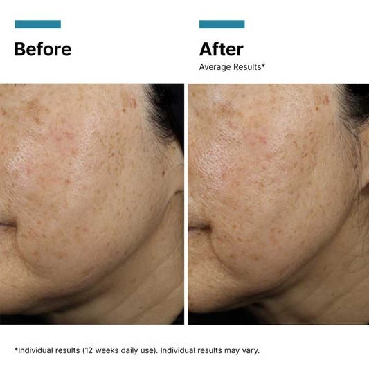 A.G.E. Interrupter Ultra Serum + Free 15ml Serum