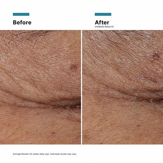 P-TIOX Anti-Wrinkle Peptide Serum by SkinCeuticals