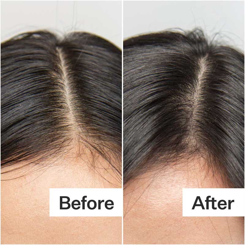 Oily Hair System by Act+Acre