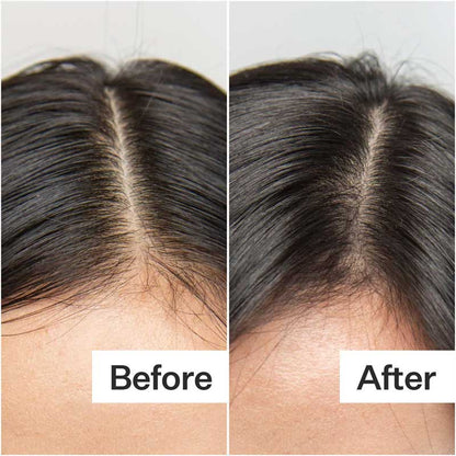 Oily Hair System by Act+Acre