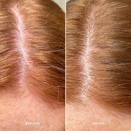 Healthy Scalp Exfoliating Treatment With Australian Desert Lime by Alpha-H