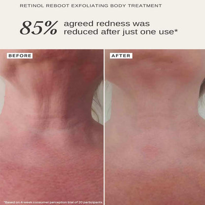 Retinol Reboot Exfoliating Body Treatment With 1% Encapsulated Retinol by Alpha-H