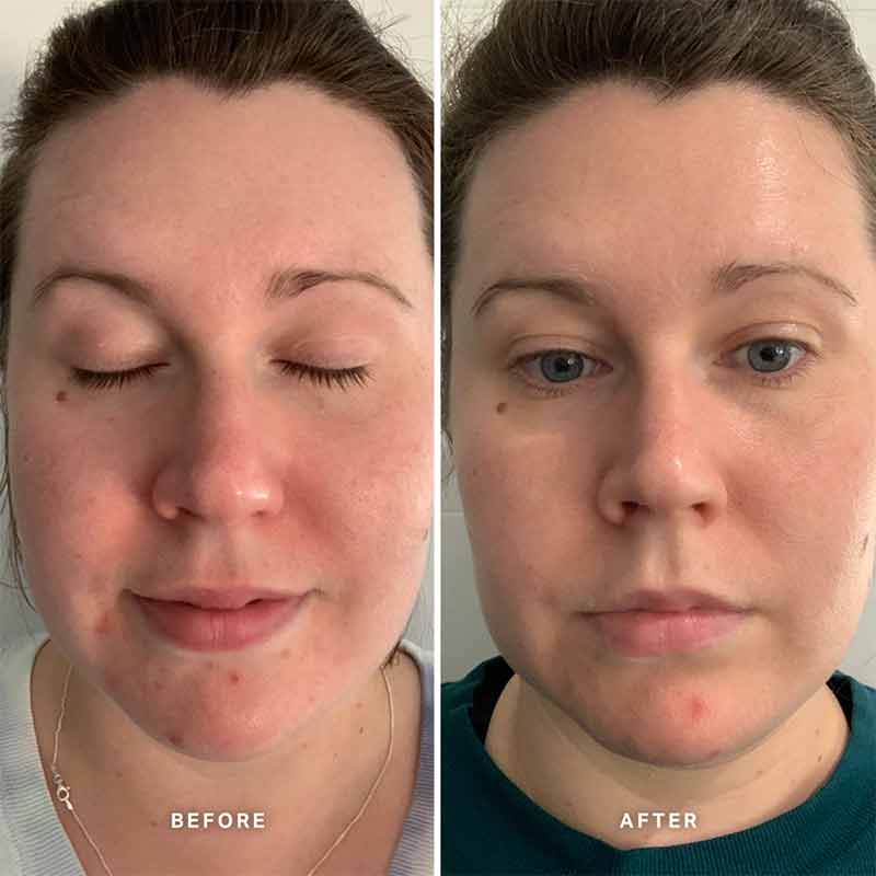 Vitamin A Serum with 0.5% Retinol by Alpha-H