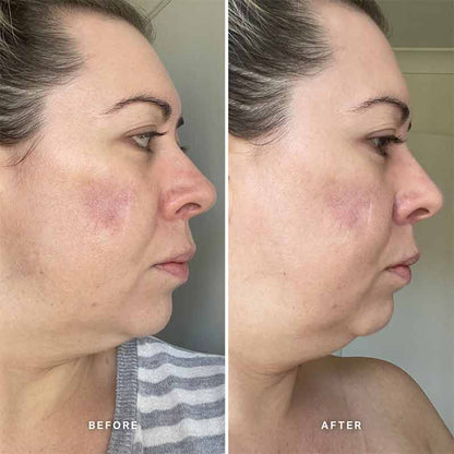 Vitamin A Serum with 0.5% Retinol by Alpha-H