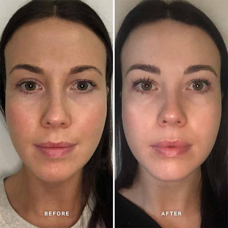 Vitamin B Serum With 5% Niacinamide
