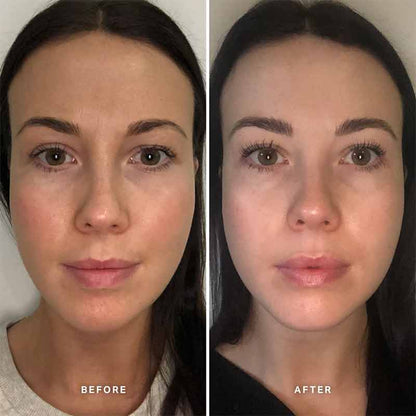 Vitamin B Serum With 5% Niacinamide