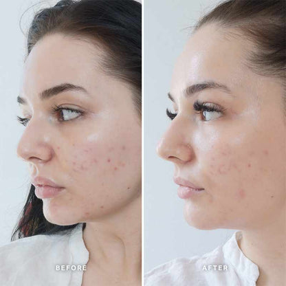 Vitamin B Serum With 5% Niacinamide
