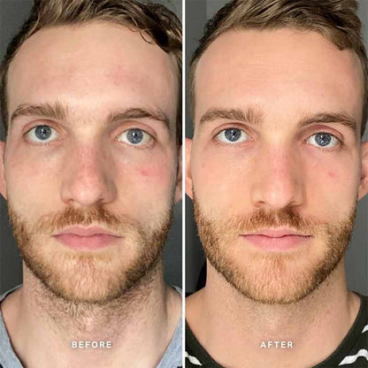 Vitamin B Serum With 5% Niacinamide