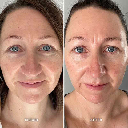 Vitamin E Serum With 1% Ceramide Complex