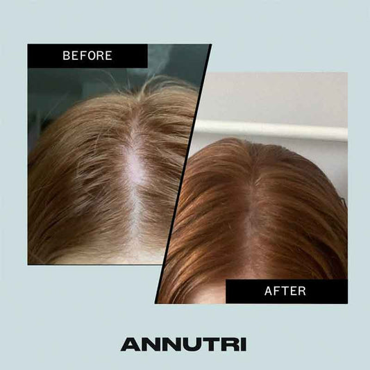 Grow It Hair Growth Supplement by Annutri