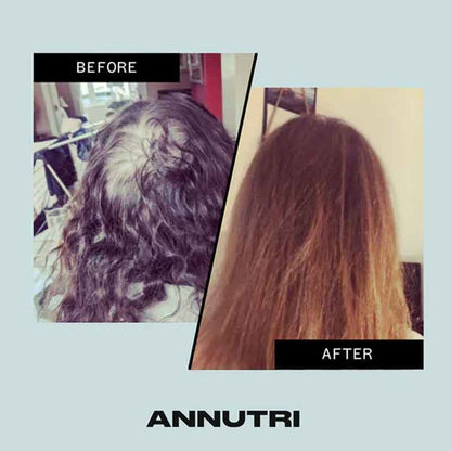 Grow It Hair Growth Supplement 3 Month Supply by Annutri
