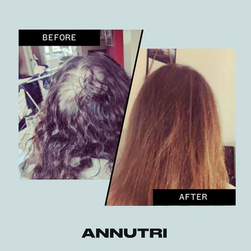 Grow It Hair Growth Supplement by Annutri