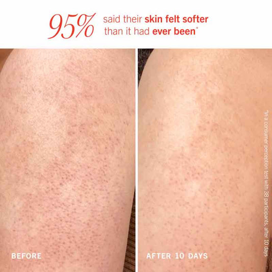 KP Bump Eraser Body Scrub with 10% AHA Peach Scent by First Aid Beauty