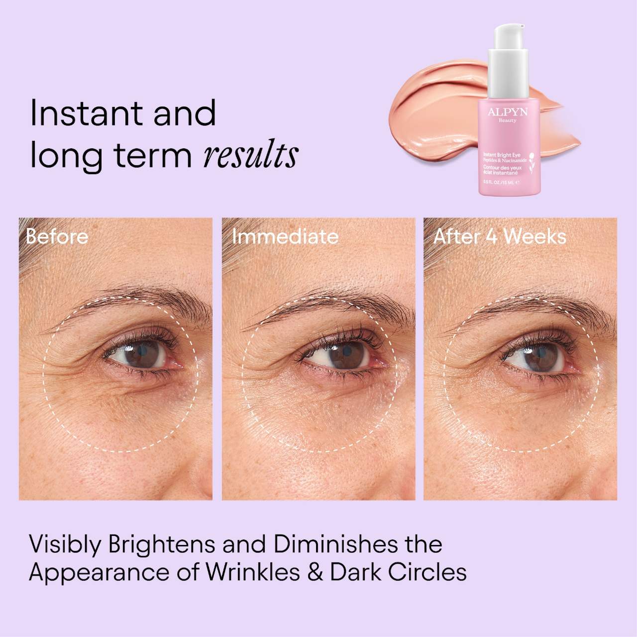 ALPYN Instant Bright Eye Dark Circle Firming Cream with Niacinamide & Peptides