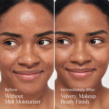 ALPYN Melt Moisturizer for Firming, Plumping & Brightening