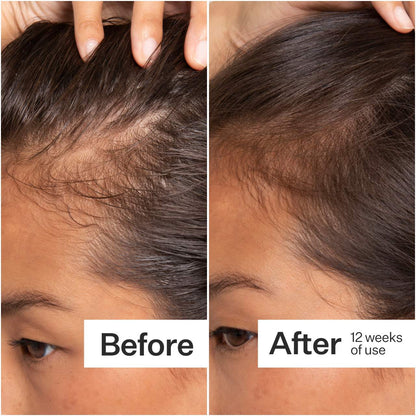Act+Acre 2% Stem Cell H-2 Grow Complex ™ Scalp Serum For Thicker-Looking Hair