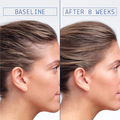 AAVRANI Hair Density Boosting Scalp Serum for Thinning Hair & Hair Loss