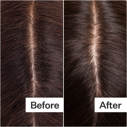 Act+Acre Cold Processed Balancing Shampoo For All Scalp + Hair Types