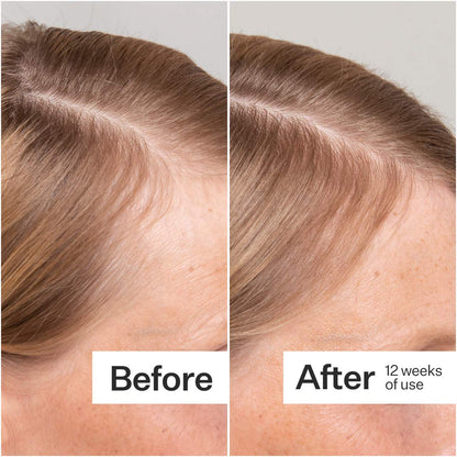 Act+Acre 2% Stem Cell H-2 Grow Complex ™ Scalp Serum For Thicker-Looking Hair