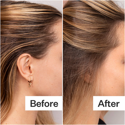 Act+Acre Fulvic Acid Volumizing Dry Shampoo Powder For Oily Scalp