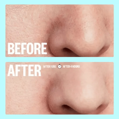 Peace Out Pores 4 Nose Strips and 4 Pore Strips