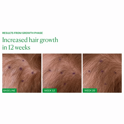The Nue Co. Growth Phase Hair Supplements (90 Capsules)