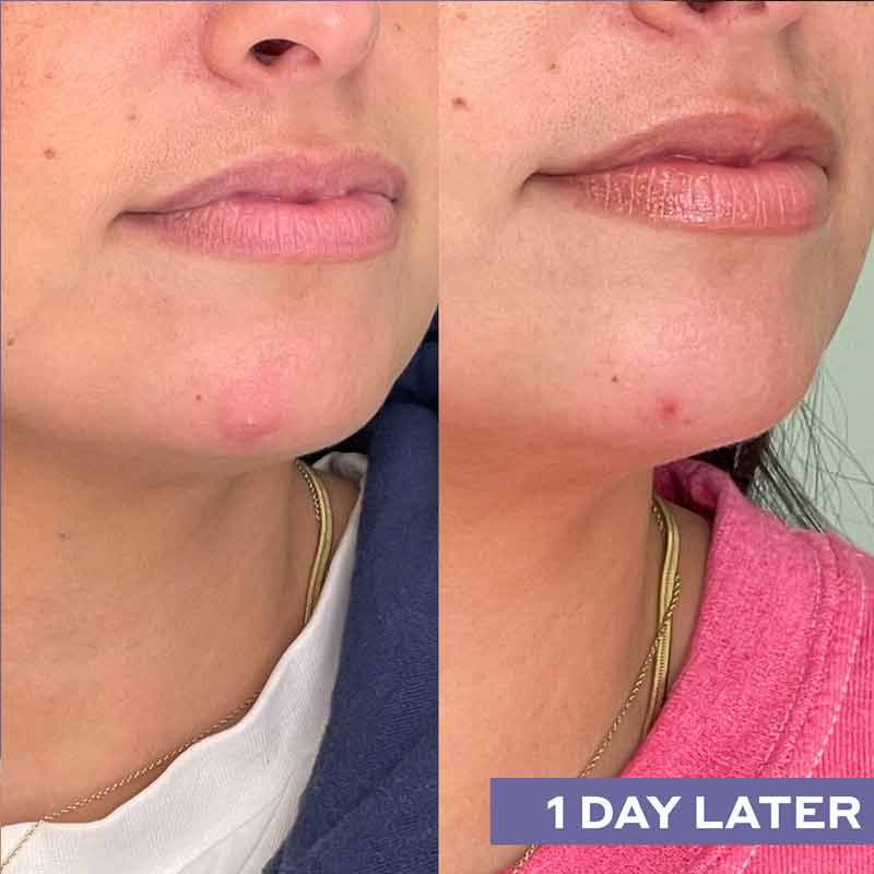 Repairing Facial Spray With Hypochlorous Acid