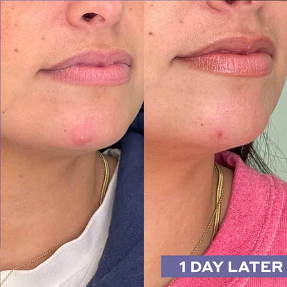 Repairing Facial Spray With Hypochlorous Acid