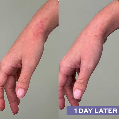 Repairing Facial Spray With Hypochlorous Acid