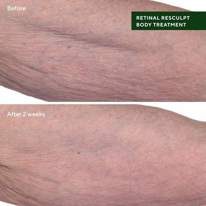 Retinal ReSculpt Body Treatment by Murad