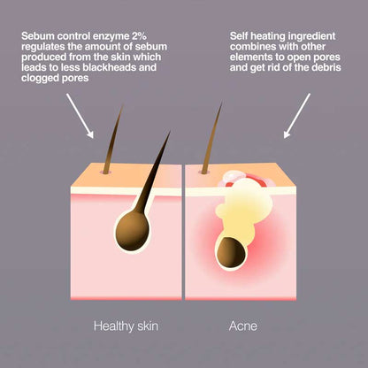Salicylic Fix Blackhead Steam Mask 8%