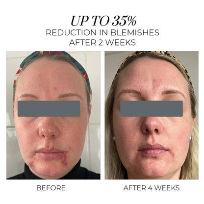 Violet Water Clearing Cleanser Blemish Control Facial Cleansing Gel