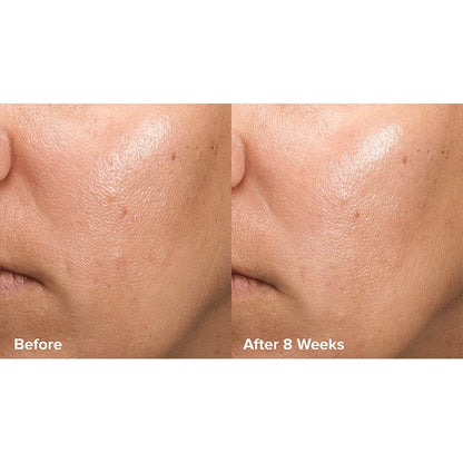 Skin Perfecting 6% Mandelic Acid + 2% Lactic Acid Liquid Exfoliant