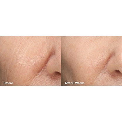 Skin Perfecting 6% Mandelic Acid + 2% Lactic Acid Liquid Exfoliant