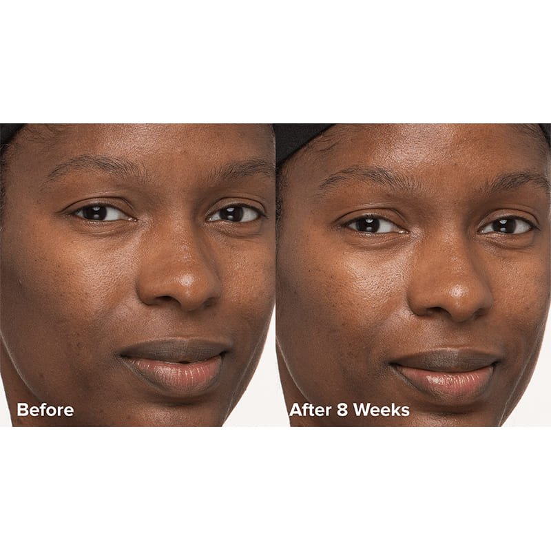 Skin Perfecting 6% Mandelic Acid + 2% Lactic Acid Liquid Exfoliant