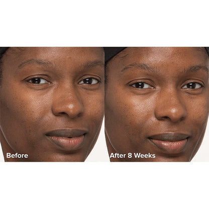 Skin Perfecting 6% Mandelic Acid + 2% Lactic Acid Liquid Exfoliant