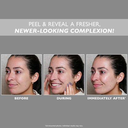 FIRMx Peeling Gel