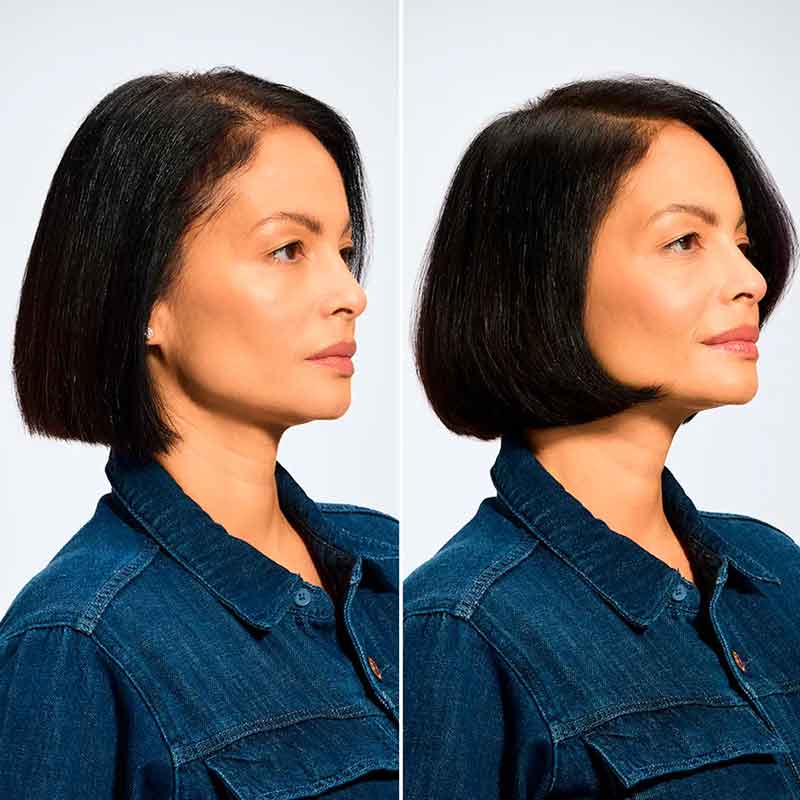 Acidic Grow Full System Hair Serum for Thin Hair by Redken