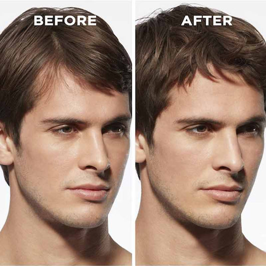 Genesis Homme Daily Anti-Hair Fall Fortifying Serum For Men by Kérastase