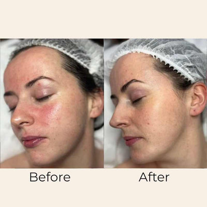 Skin Mist Ceramide & Hyaluronic by Skin Formulas