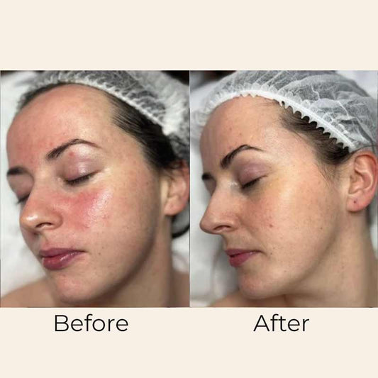 Skin Mist Ceramide & Hyaluronic by Skin Formulas