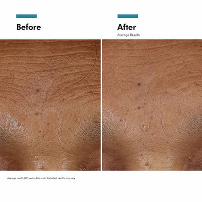 HA Intensifier Multi-Glycan Serum + Free 15ml Gift