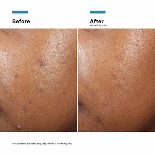 Phyto A+ Brightening Treatment Moisturiser