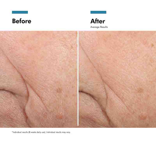 Triple Lipid Restore 2:4:2 Moisturiser by SkinCeuticals