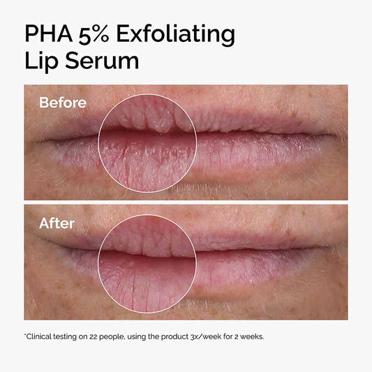 PHA 5% Exfoliating Lip Serum by The Ordinary