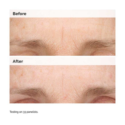 Retinal 0.2% Emulsion by The Ordinary