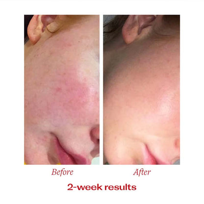 Vitamin C Booster Treatment by Trilogy